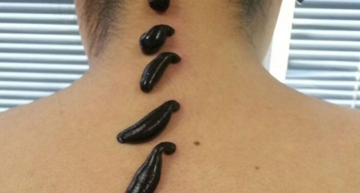 Пиявки медицинские: достоинства и описание, правила применения